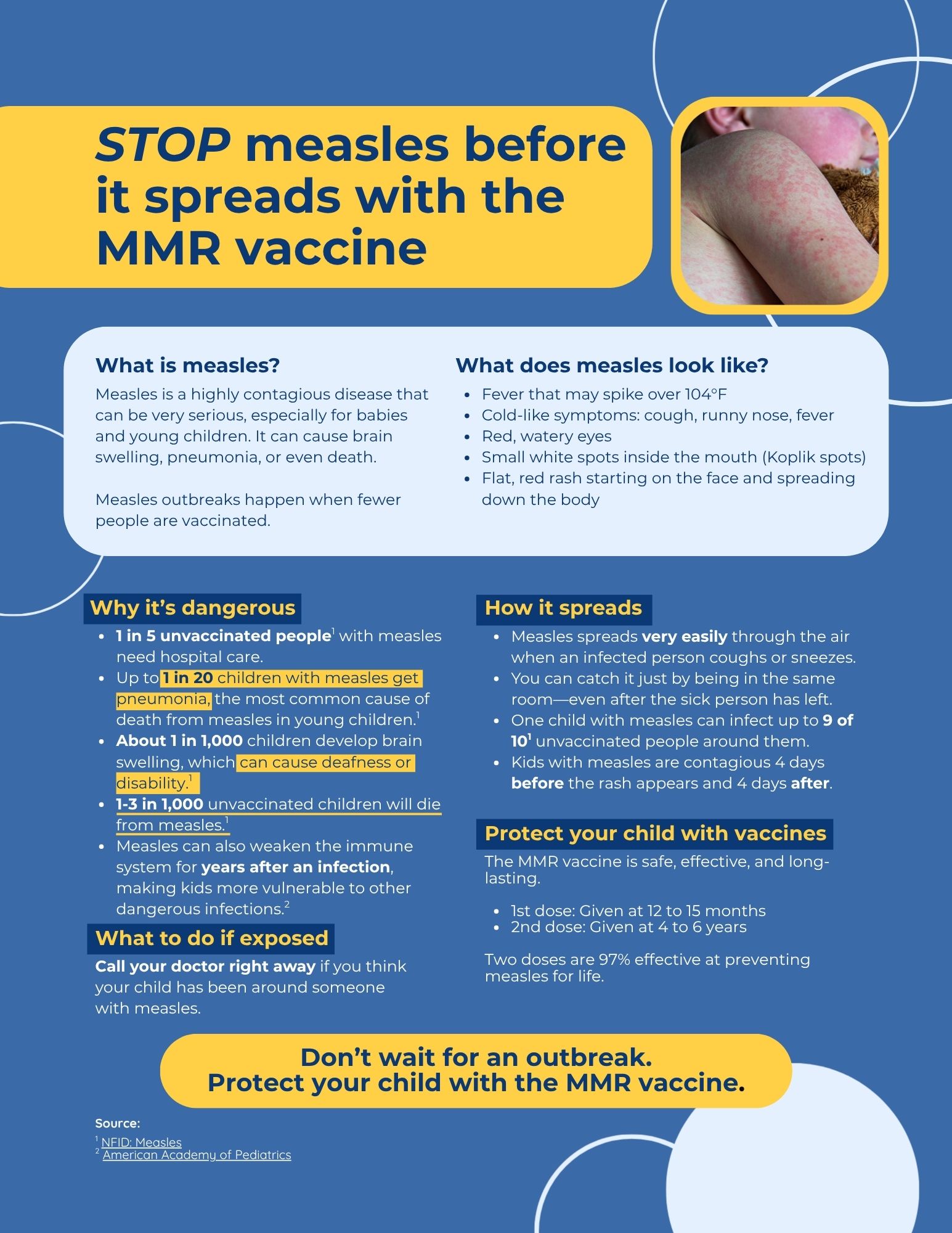 Factsheet explains what measles is, why it's so dangerous for unvaccinated children, and how two doses of the MMR vaccine protect children against measles for life.